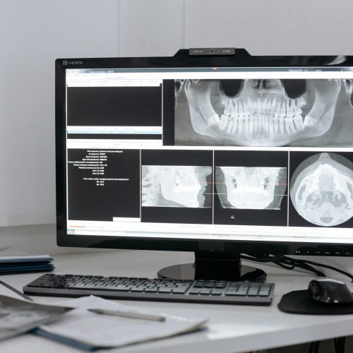 xray result